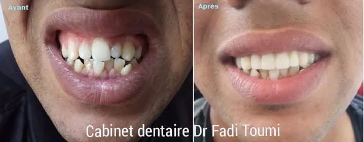 Orthodontie enfant et pédiatrique